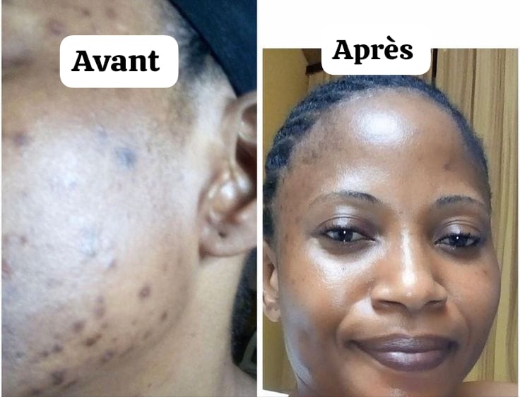 KIT CURCUMA : Coton curcuma + Sérum au curcuma + Masque au curcuma + Crème solaire La Roche Posail