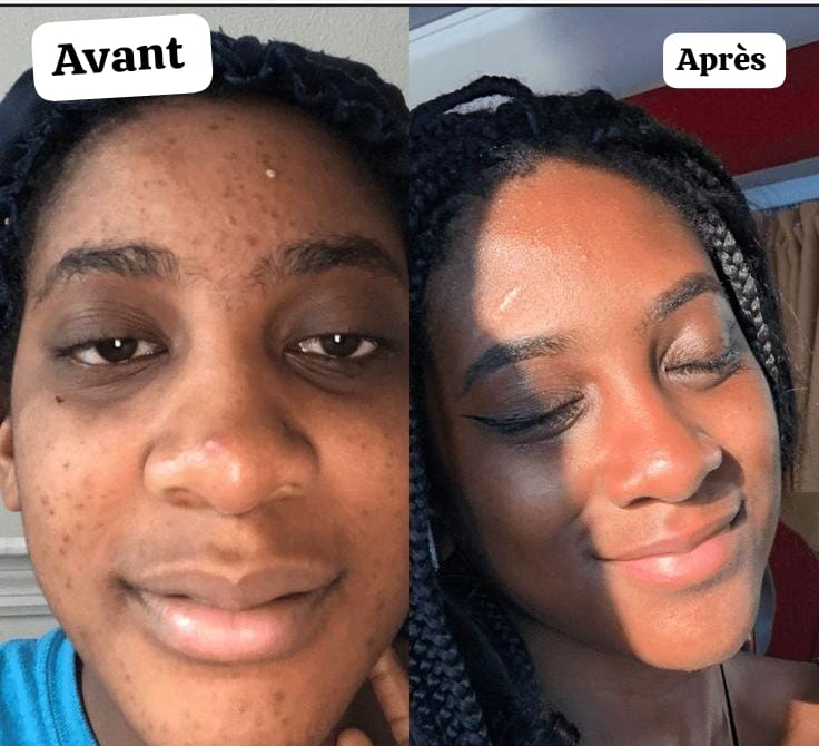 Pack Beauté Divine : 1 Masque Collagène + 3 Masques Curcuma