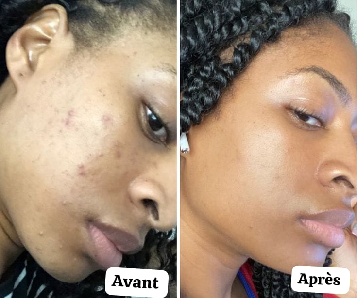 KIT CURCUMA : Coton curcuma + Sérum au curcuma + Masque au curcuma + Crème solaire La Roche Posail