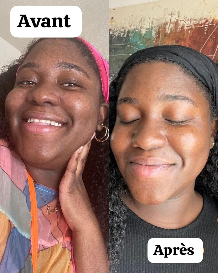 KIT CURCUMA : Coton curcuma + Sérum au curcuma + Masque au curcuma + Crème solaire La Roche Posail