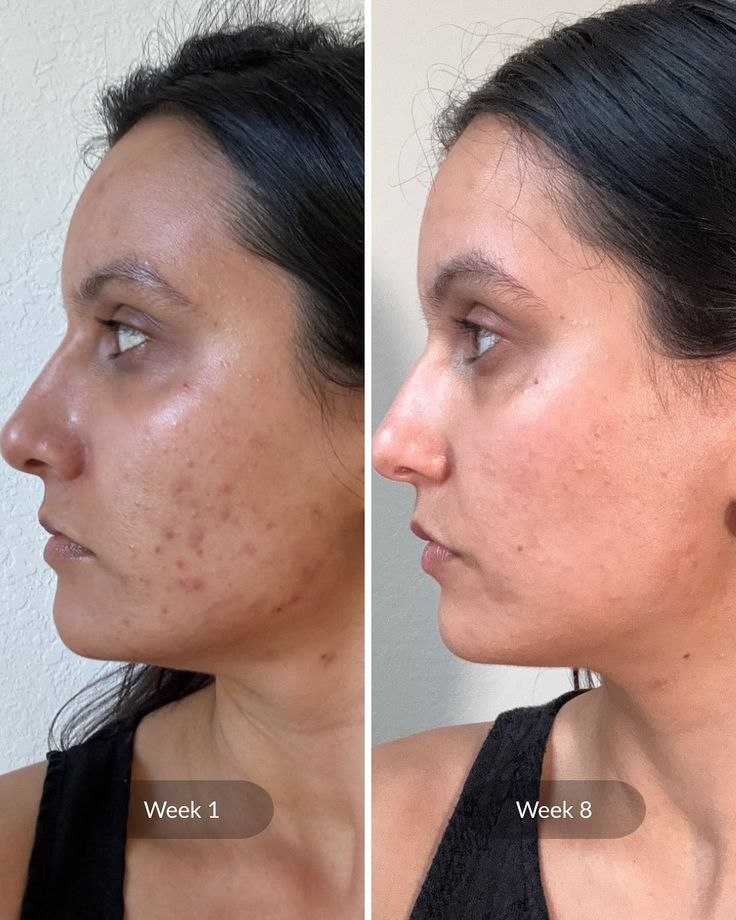 Pack Beauté Divine : 1 Masque Collagène + 3 Masques Curcuma